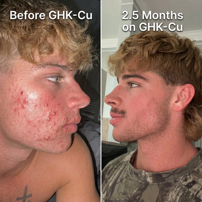 Max Your Skin | Mela Glow Stack